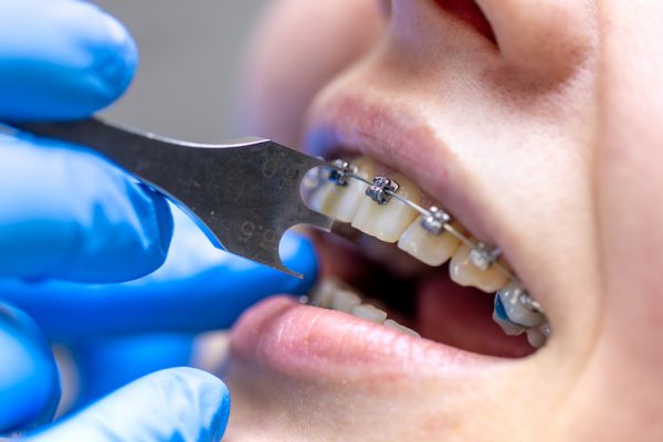 Orthodontics